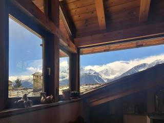 Villa unifamiliare frazione Remondey, La Salle — foto 17 di 108