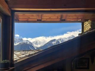 Villa unifamiliare frazione Remondey, La Salle — foto 49 di 108